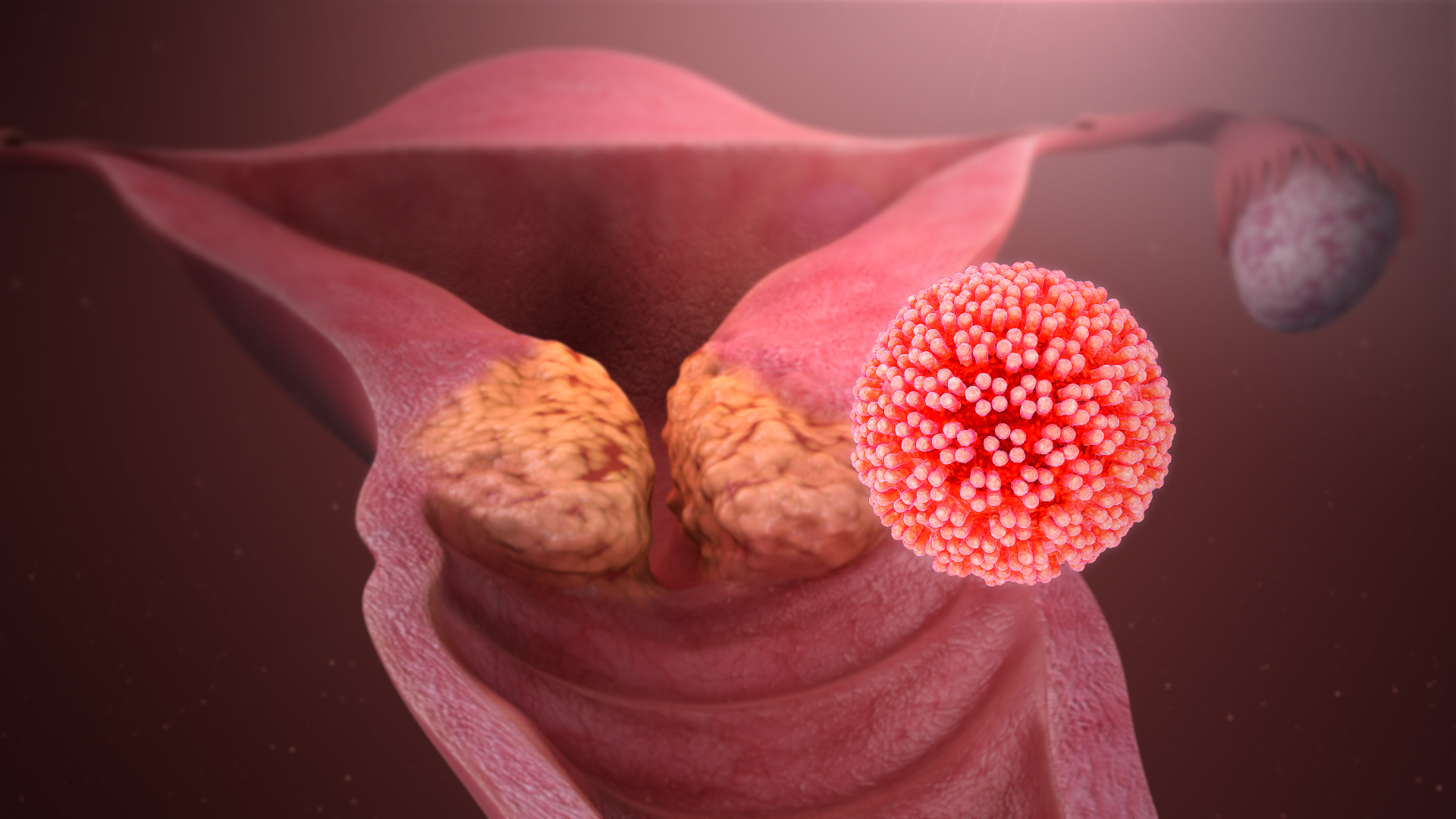 hpv rachen behandlung